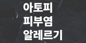 아토피-피부염과-알레르기의-연관성-관리노하우