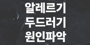 알레르기-두드러기-원인파악-관리법