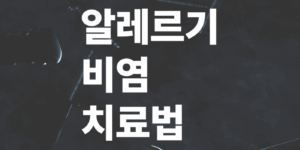 알레르기성-비염-치료법-일상관리-팁-필독