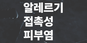알레르기성-접촉성-피부염-원인과-치료방법